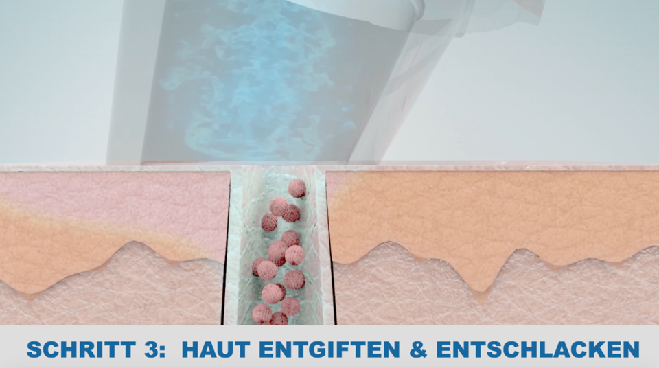 Grafik-3-fuer-Schritt-3-DETOX